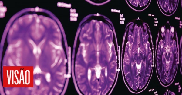 Cérebro: As idades que marcam pontos de viragem (com direito a uma transição disruptiva)