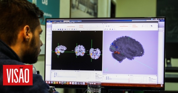 O que uma lesão cerebral nos pode tirar… sem nos tirar a vida