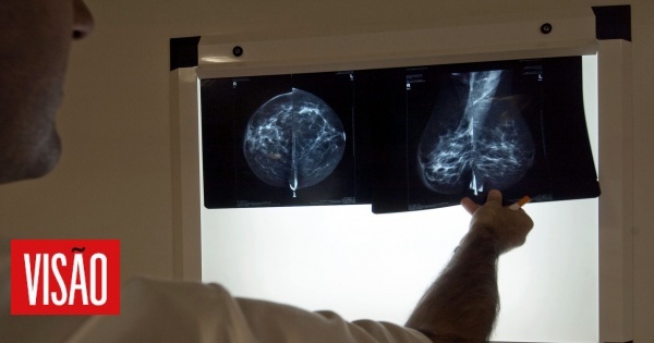 Cancro da mama: o que os números não nos dizem. Por um investigador
