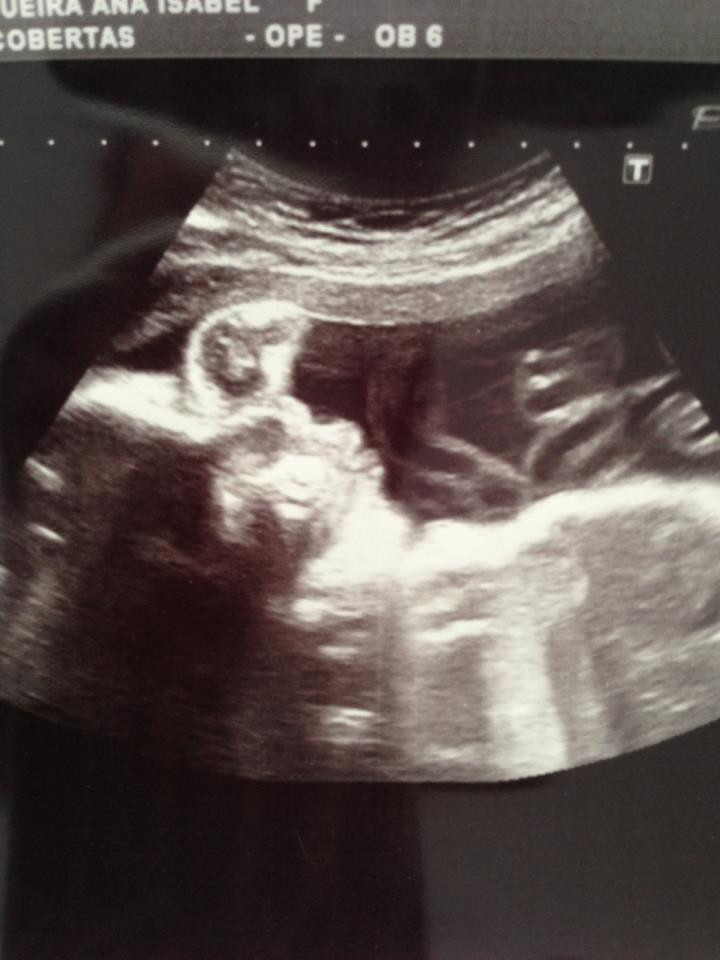 Caras Isabel Figueira Partilha Com Fas Ecografia Do Bebe