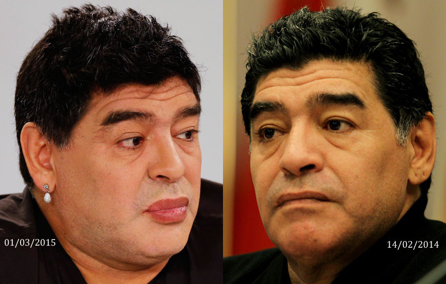 Diego Maradona fez cirurgia plástica ao rosto - Jogo da Vida