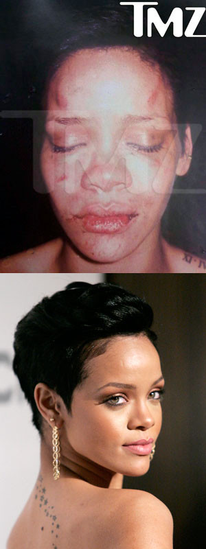 Foto chocante prova agressão de Chris Brown a Rihanna