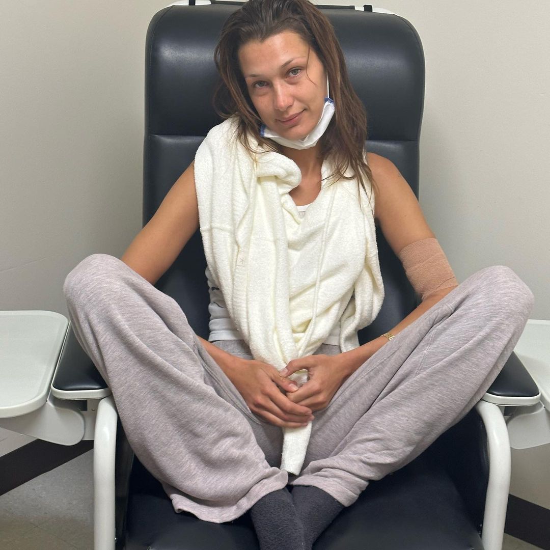 Bella Hadid partilha imagens fortes do tratamento contra a doença de Lyme